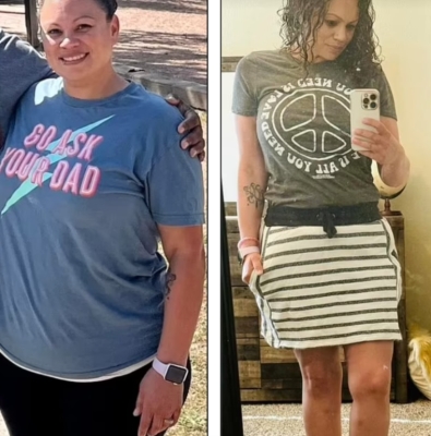 صديقتان تناولتا أدوية التنحيف في نفس الوقت.. ما حدث بعد ذلك مفاجأة