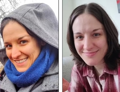 صور صادمة لامرأة تدعي تغيّر لون بشرتها لإفراطها في تناول الجزر