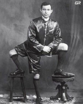 بثلاث أرجل وجهازين تناسليين.. تعرفوا إلى قصة فرانك لينتيني