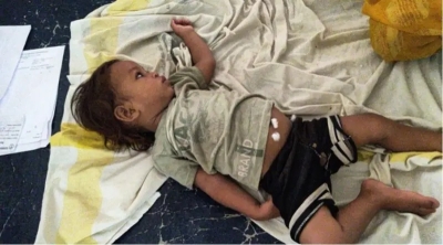 الطفل الأعجوبة .. عضّ أفعى كوبرا حتى الموت