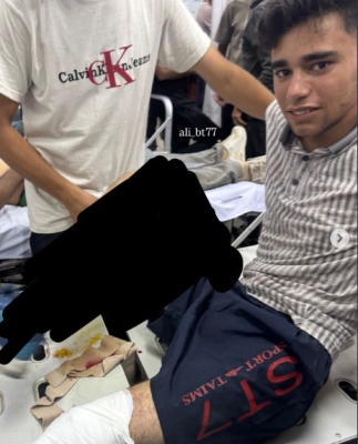 إصابة الناشط عبود بطاح خلال تغطيته أزمة المساعدات في غزة - صور