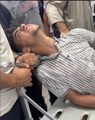 إصابة الناشط عبود بطاح خلال تغطيته أزمة المساعدات في غزة - صور