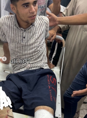 إصابة الناشط عبود بطاح خلال تغطيته أزمة المساعدات في غزة - صور