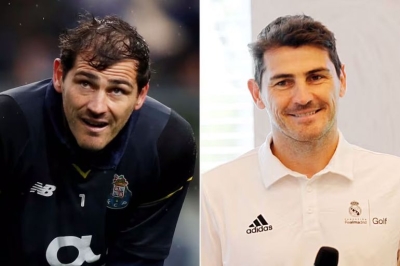 زراعة الشعر.. سر جديد في حياة نجوم الكرة