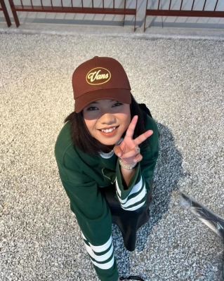 امرأة ماليزية تكشف معاناة 9 أشهر من تغير ملامحها خلال الحمل - صور