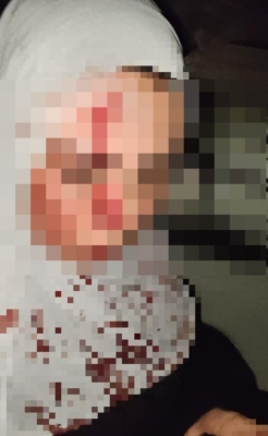 مصر.. عصابة نسائية تهاجم فتاتين وتنهب مدخراتهما المخصصة للعمرة - صور