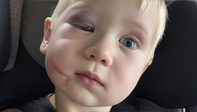 كدمات وخدوش مروعة.. موظفة حضانة تعتدي بوحشية على رضيع في يومه الأول