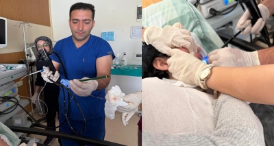 بسبب اضطراب نادر.. استخراج قلمين من معدة شابة تركية! (صور)