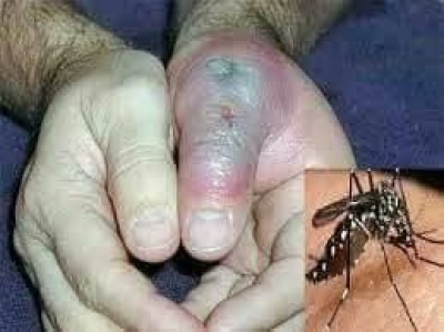 ما هي ذبابة الرمل (النمر الأسود) التي أودت بحياة الطفل الأردني عمر؟ – صور