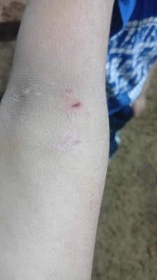 طفل يتعرض لعضة كلب ضال في منتزه للأطفال بالكرك - صور