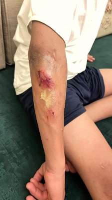 4 كلاب ضالة تهاجم طفلاً في البادية الشمالية - صور