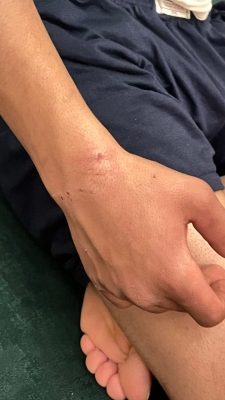 4 كلاب ضالة تهاجم طفلاً في البادية الشمالية - صور