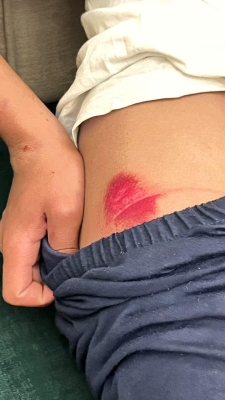 4 كلاب ضالة تهاجم طفلاً في البادية الشمالية - صور