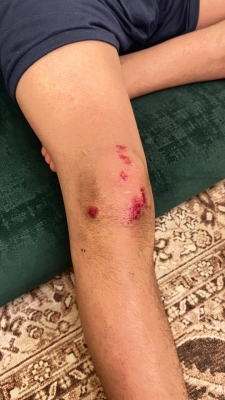 4 كلاب ضالة تهاجم طفلاً في البادية الشمالية - صور