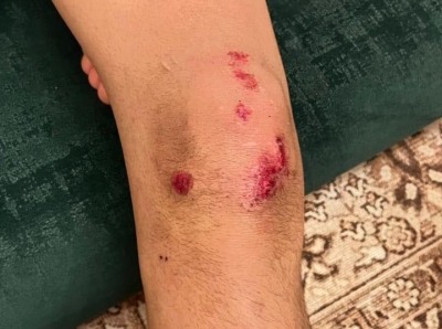 4 كلاب ضالة تهاجم طفلاً في البادية الشمالية - صور