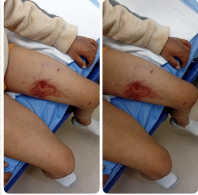 الأردن.. كلب ضال ينهش جسد طفل في القطرانة - صورة