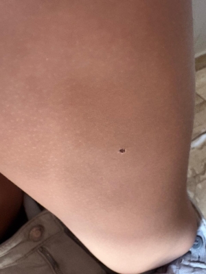 طبيب أردني: خدش قطة كاد أن يدمّر طفلة.. والتشخيص أنقذها بـ5 دنانير - صور