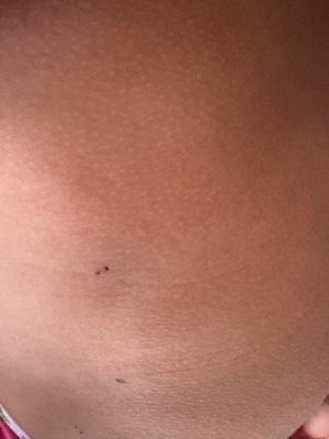 طبيب أردني: خدش قطة كاد أن يدمّر طفلة.. والتشخيص أنقذها بـ5 دنانير - صور