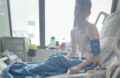 صور مُفزعة.. هكذا دمر (التدخين الإلكتروني) رئة مراهق لم يتجاوز 17 عاماً