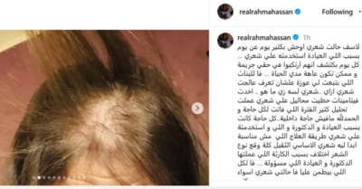 عاهة مستديمة.. فنانة مصرية تواجه صلعاً جزئياً بسبب جلسة تجميل خاطئة