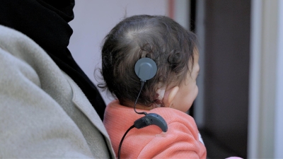 مستشفى الاستقلال يختتم مرحلة زراعة القوقعة الإلكترونية لأطفال فلسطين ضمن مشروع إنساني بدعم مركز الملك سلمان