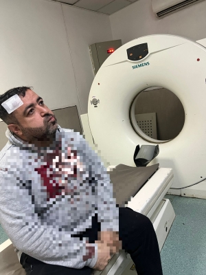 الأمن: التحقيق في حادثة الاعتداء على الصحفي التميمي - فيديو