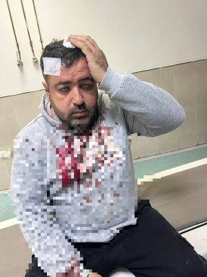 ضبط المعتدين على الصحفي التميمي في الزرقاء - فيديو