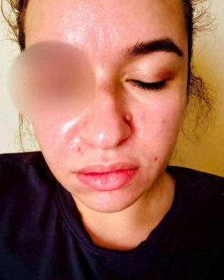 إصابات وكدمات.. زوجة فنان مصري تتهمه بضربها وسحلها