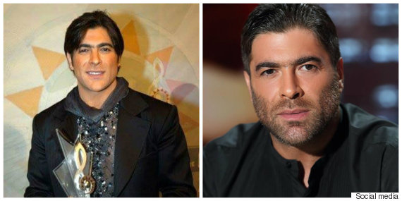 نجوم تغيرت ملامحهم بالتجميل -صور