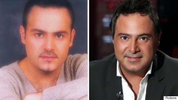 نجوم تغيرت ملامحهم بالتجميل -صور