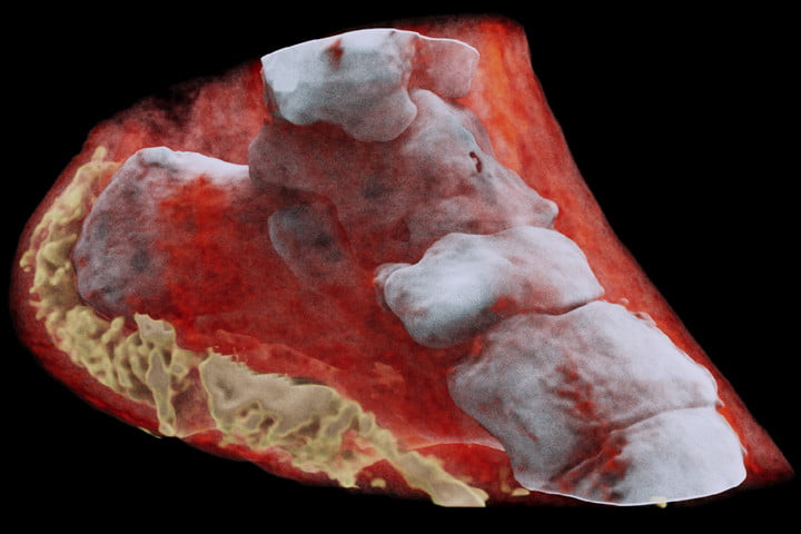 أخيراً.. صور الأشعة أصبحت ملونة