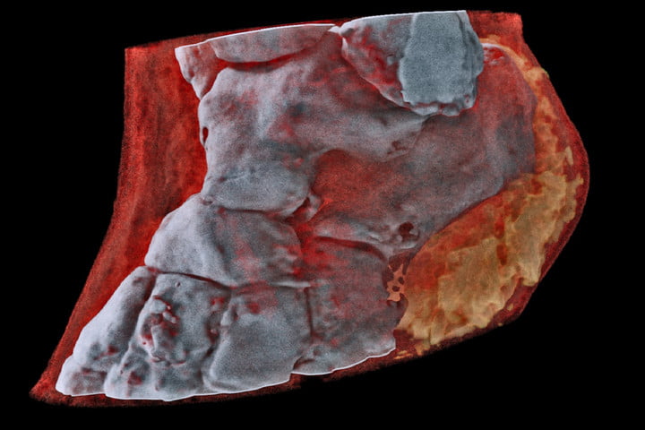 أخيراً.. صور الأشعة أصبحت ملونة