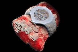 أخيراً.. صور الأشعة أصبحت ملونة