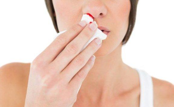 ما أسباب نزيف الأنف في الليل