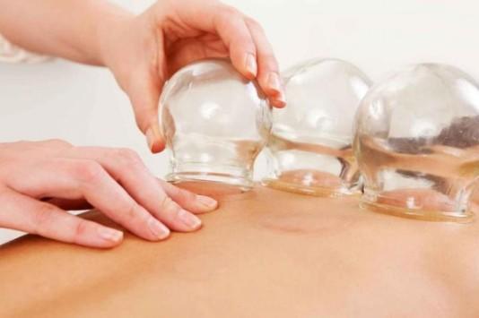 ما أفضل أوقات العلاج بالحجامة