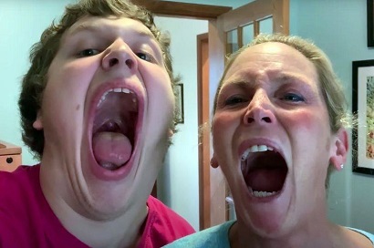  يدخل موسوعة غينيس لأكبر تجويف فم