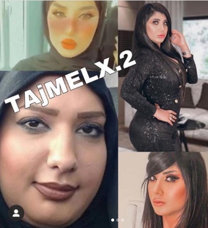 سارة الكندري قبل عمليات التجميل - صورة 