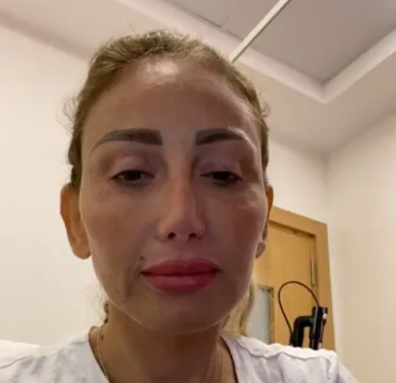 ريهام سعيد بعد آخر عملية تجميل - صورة 