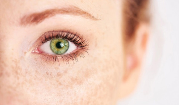 تعرف إلى أندر ألوان العيون وأكثرها غرابة بالعالم