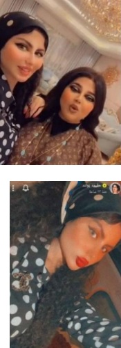 حليمة بولند بشكل جديد بعد عمليات التجميل - صور 