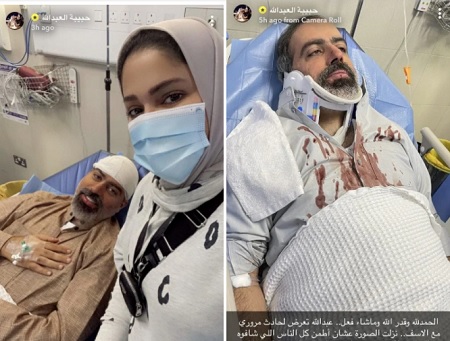 إصابة الفنان الكويتي عبدالله التركماني بحادث سير 