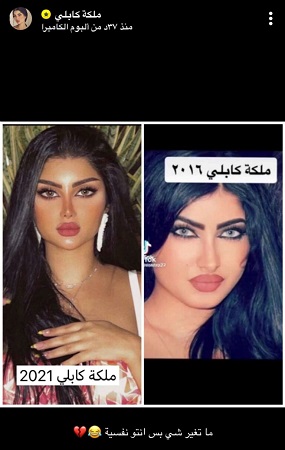 ملكة كابلي تقارن بصورة قبل الشهرة وبعدها