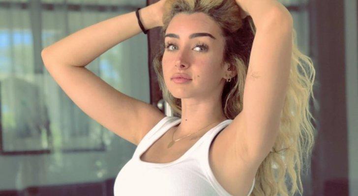 هنا الزاهد وصورة قبل وبعد عملية تجميل أنفها