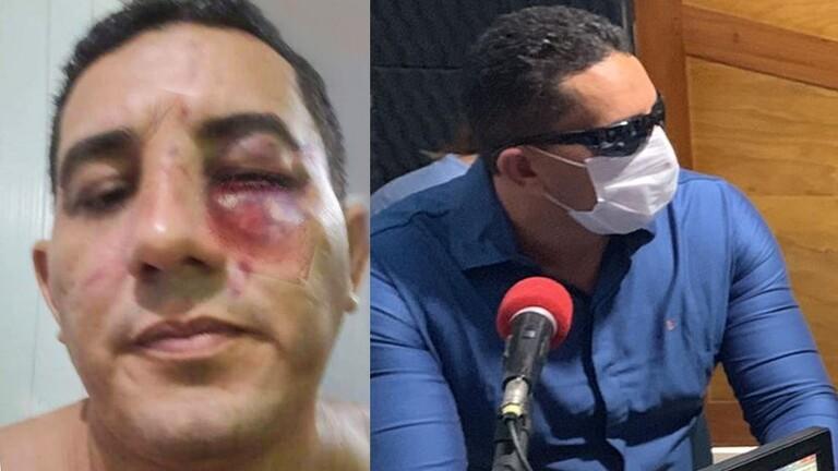 سياسيان برازيليان يحلان الخلافات السياسية في حلبة الملاكمة  فيديو