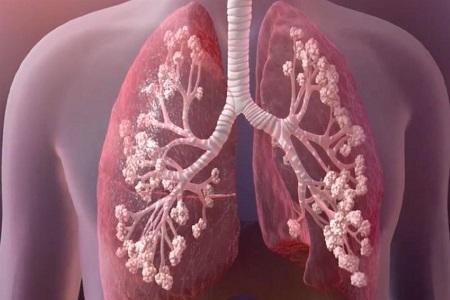 مستشفى إسرائيلي يعالج أردنيا من مرض نادر