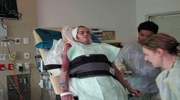  يتعافى بأعجوبة من صدمتين كهربائتين عنيفتين 