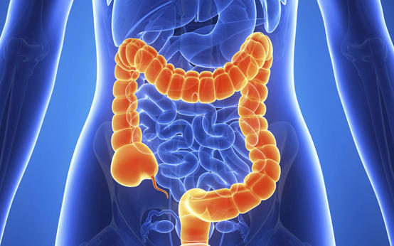 أبرز أسباب الإصابة بالتهاب القولون التقرحي