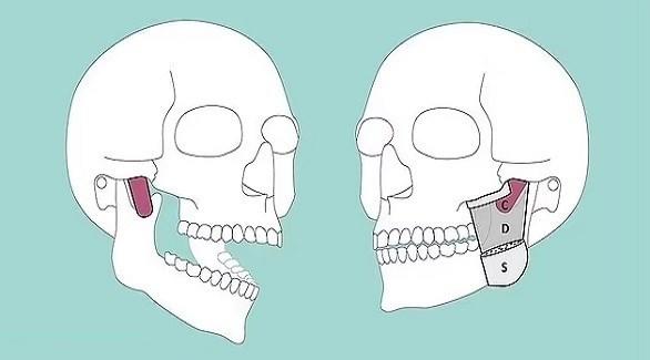  اكتشاف طبقة عضلية في الفك السفلي تساعد على المضغ