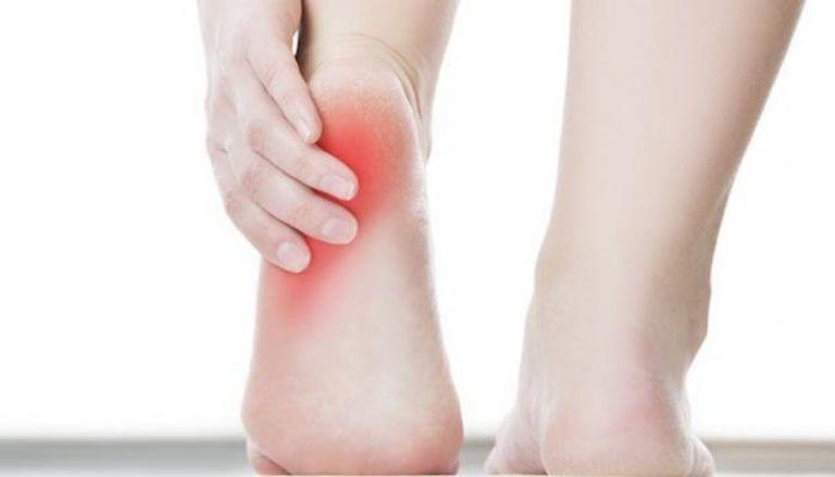 آلام الكعب الأسباب والعلاج