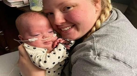  امرأة برحمين تلد طفلة وهي في شهرها الخامس